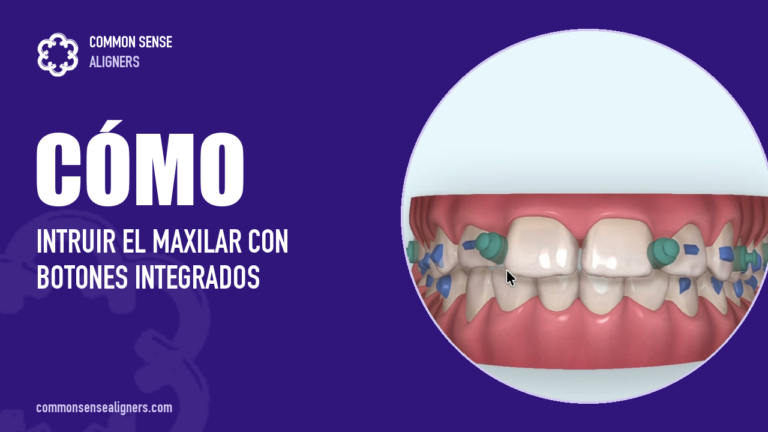 Botones integrados y minitornillos: intruir el maxilar sin programar el movimiento