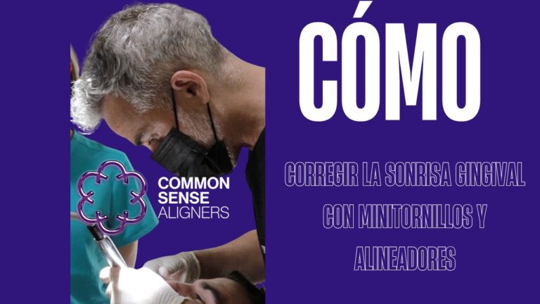 Corregir la sonrisa gingival con minitornillos y alineadores