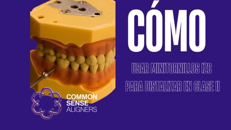 Minitornillos infracigomáticos para resolver una clase II con mordida abierta