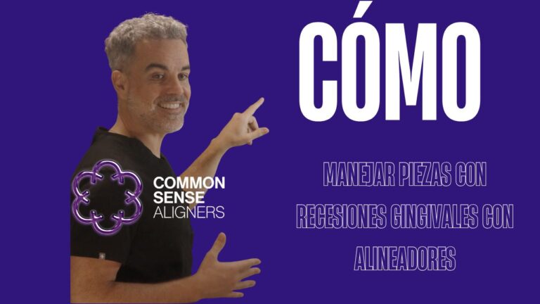 Cómo manejar piezas con recesiones gingivales con alineadores