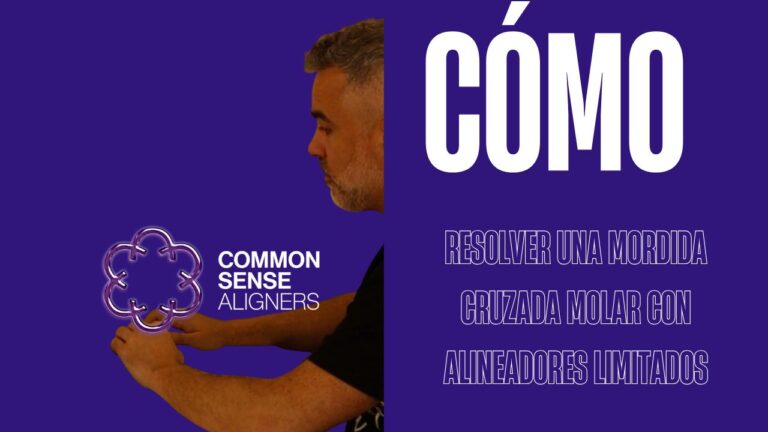 Cómo resolver una mordida cruzada molar con alineadores limitados