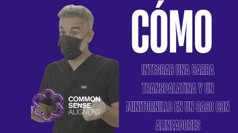 Integrar una barra transpalatina y un minitornillo en un caso con alineadores