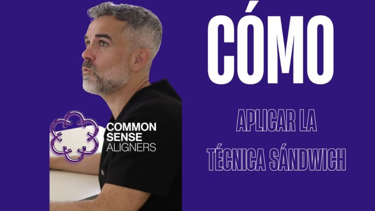 La técnica sándwich: resolver apiñamientos severos sin stripping, sin extracciones y sin minitornillos