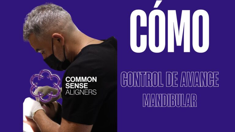 Control del avance mandibular con alineadores
